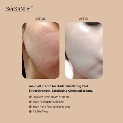 كريم ميلا أوف للتقشير البارد