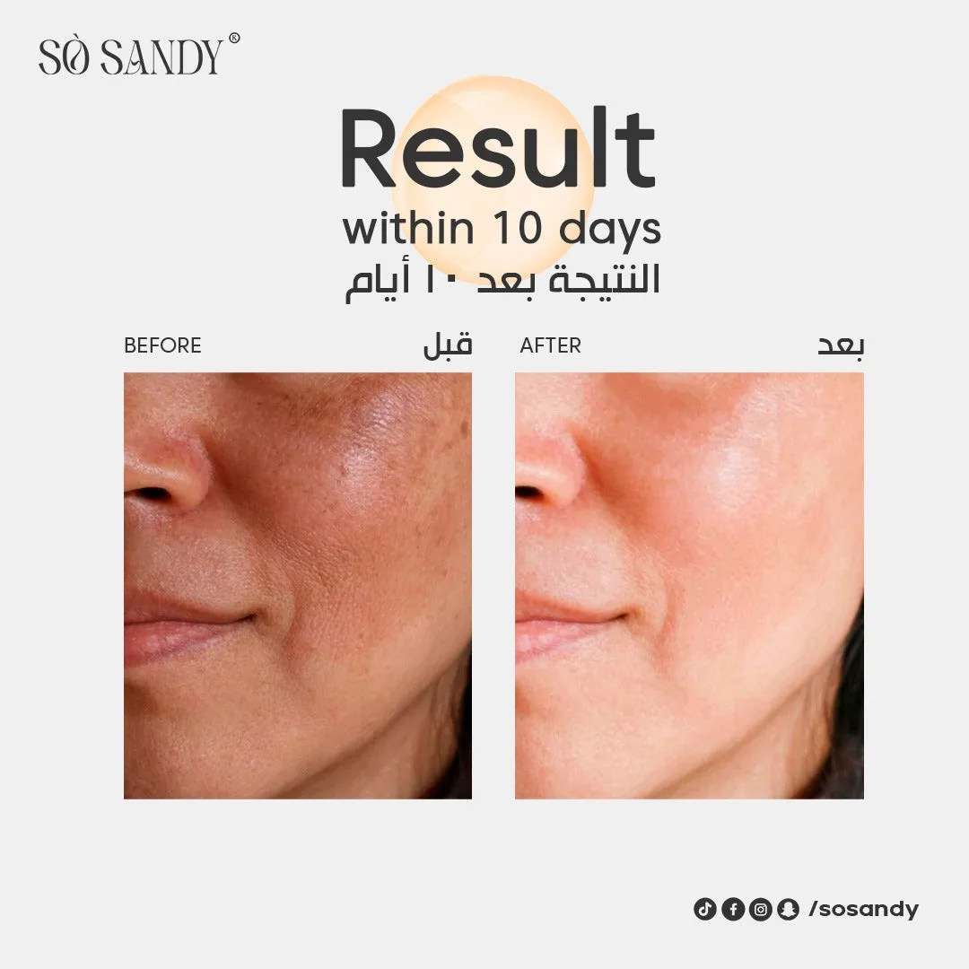 ⁦سيروم شاين اند وايت للوجه 30 مل⁩ - الصورة ⁦3⁩